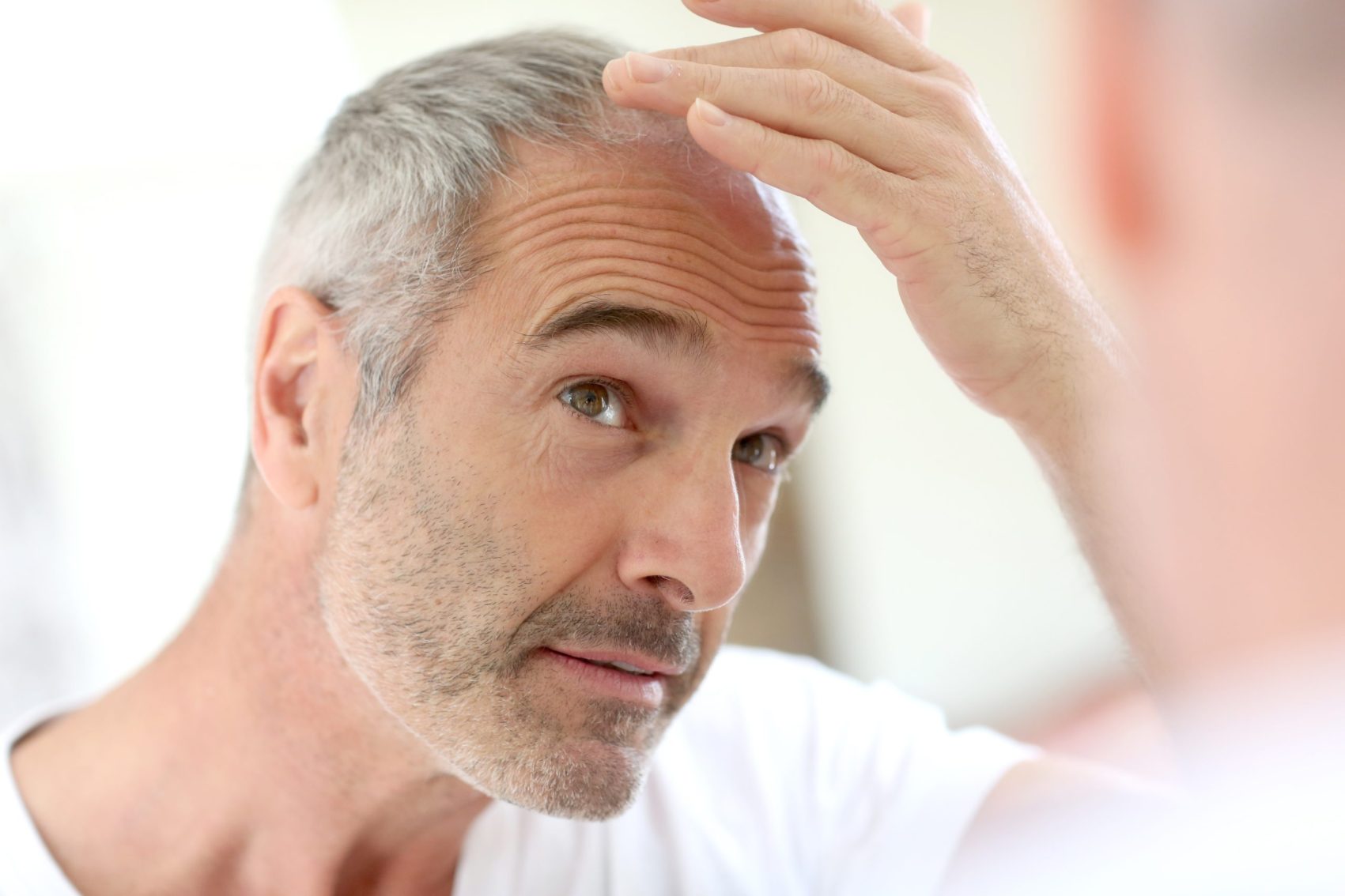 Middle-aged man examining hairline, representing hair regrowth from Finasteride and Minoxidil therapy.